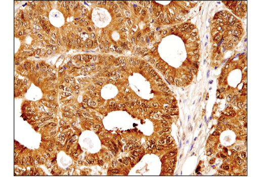 undefined Image 29: Microglia Neurodegeneration Module Antibody Sampler Kit