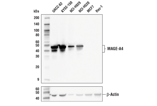 Western Blotting Image 1: MAGE-A4 (E7O1U) XP<sup>®</sup> Rabbit mAb (BSA and Azide Free)