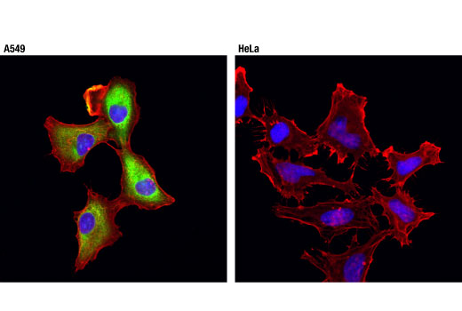 Immunofluorescence Image 1: ALDH1A1 (D9J7R) XP<sup>®</sup> Rabbit mAb