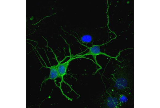 Immunofluorescence Image 1: CaMKII-α (6G9) Mouse mAb