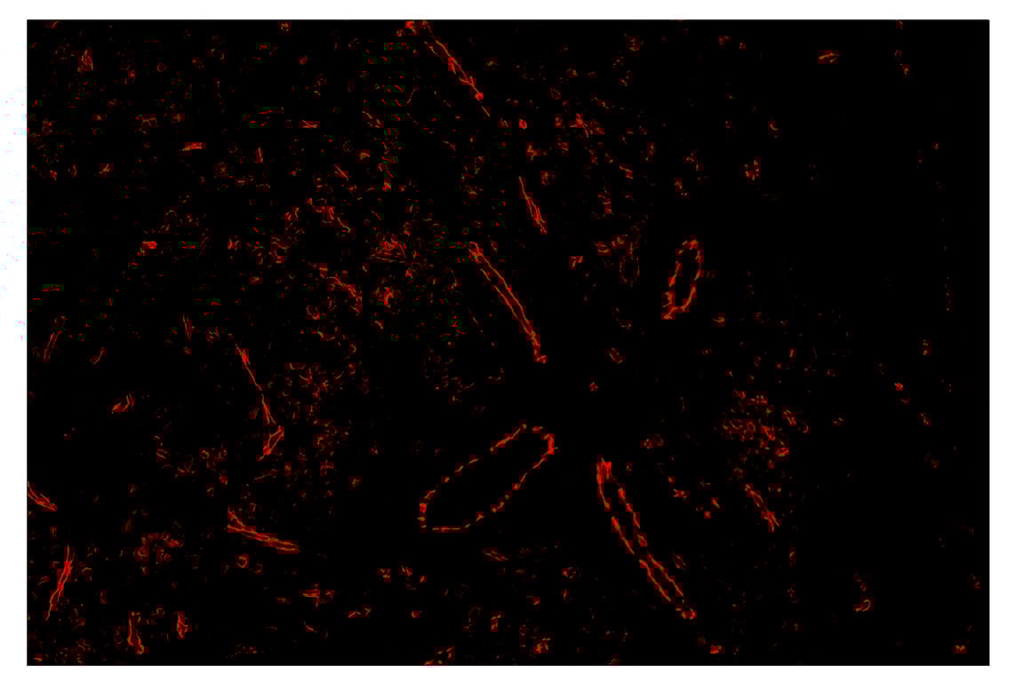 Immunohistochemistry Image 4: CD31 (PECAM-1) (89C2) & CO-0028-750 SignalStar<sup>™</sup> Oligo-Antibody Pair
