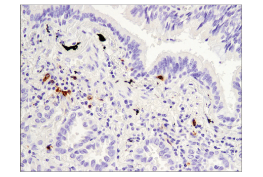 Immunohistochemistry Image 3: OX40 (E9U7O) XP<sup>®</sup> Rabbit mAb (BSA and Azide Free)