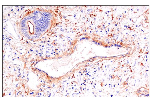Immunohistochemistry Image 2: DAF/CD55 (E7G2U) XP<sup>®</sup> Rabbit mAb