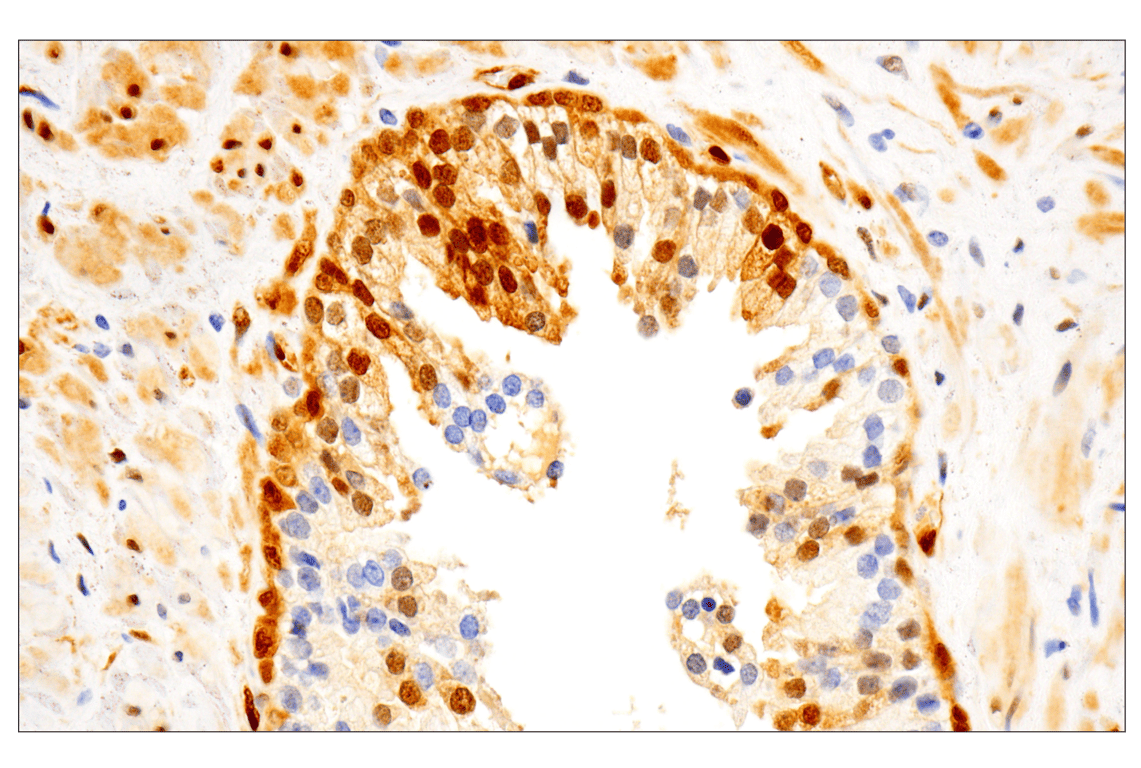 undefined Image 52: Cannabinoid Receptor 1 Downstream Signaling Antibody Sampler Kit