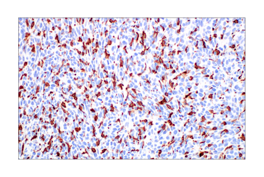 undefined Image 48: Mouse Reactive M1 vs M2 Macrophage IHC Antibody Sampler Kit