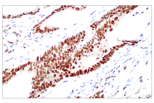 Immunohistochemistry Image 1: Ezh2 (D2C9) XP<sup>®</sup> Rabbit mAb (BSA and Azide Free)