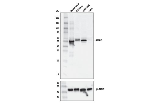 Western Blotting Image 1: GFAP (E6N9L) Mouse mAb
