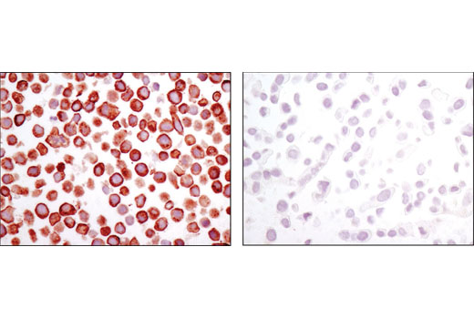 Immunohistochemistry Image 4: Met (D1C2) XP<sup>®</sup> Rabbit mAb (BSA and Azide Free)