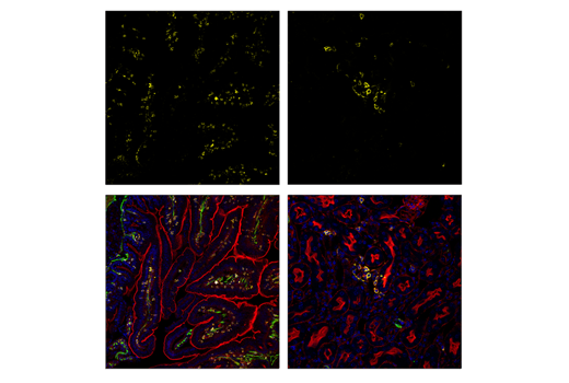 Immunofluorescence Image 1: CD45 (D3F8Q) Rabbit mAb (Alexa Fluor<sup>®</sup> 594 Conjugate)