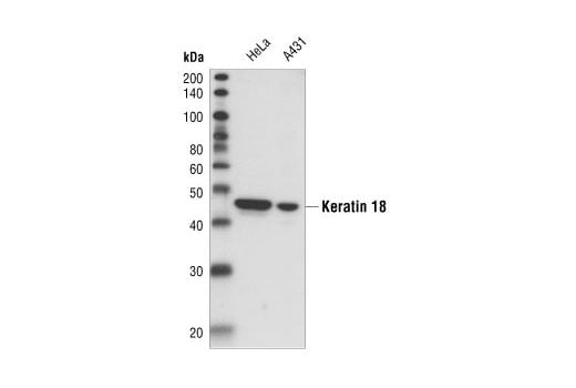 Western Blotting Image 1: Keratin 18 (DC10) Mouse mAb