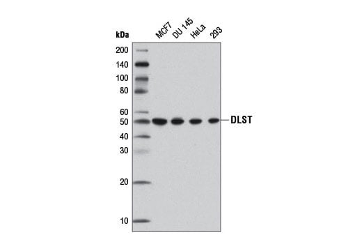 Western Blotting Image 1: DLST (D22B1) XP<sup>®</sup> Rabbit mAb