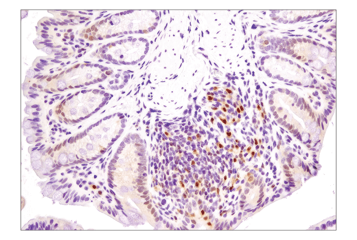 undefined Image 27: Angiogenesis Antibody Sampler Kit