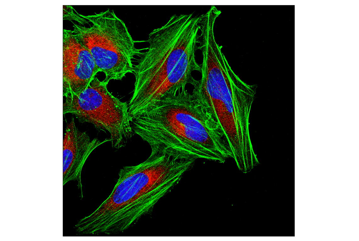 Immunofluorescence Image 1: β-Actin (E4D9Z) Mouse mAb