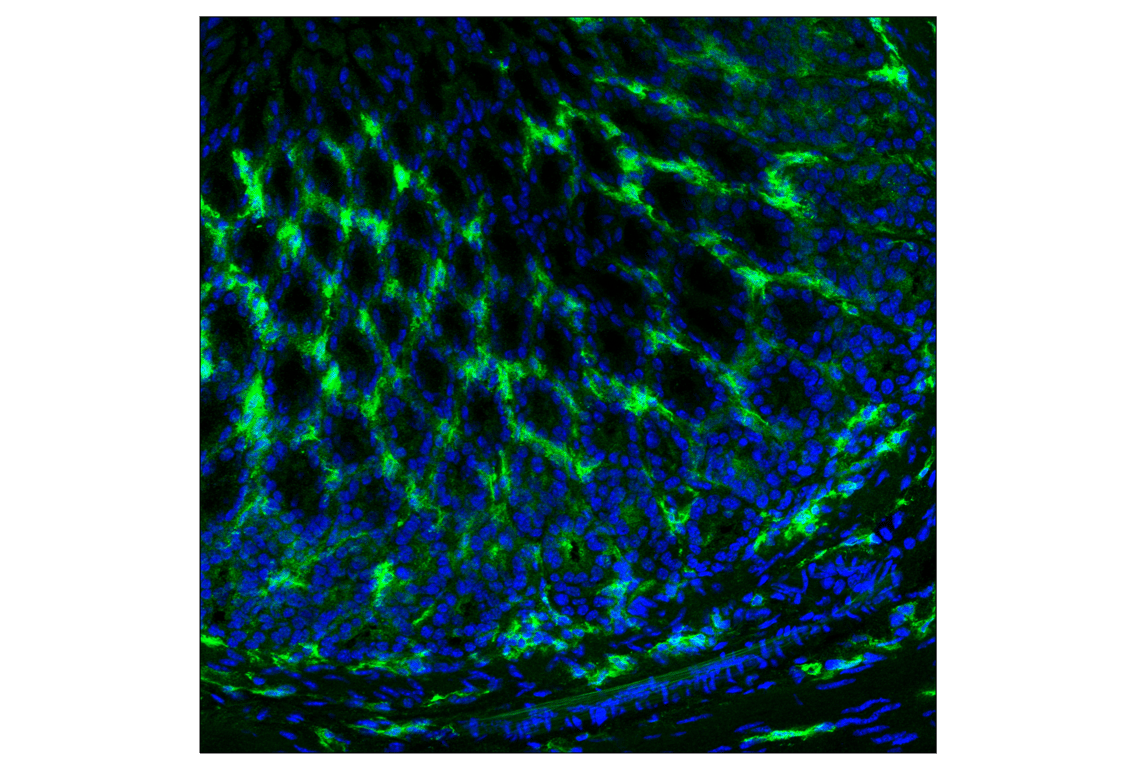 Immunofluorescence Image 2: CD14 (D1U2Y) Rabbit mAb