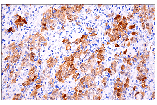 Immunohistochemistry Image 4: Calretinin (E7R6O) XP<sup>®</sup> Rabbit mAb