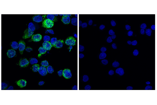 undefined Image 26: Mouse Reactive M1 vs M2 Macrophage IHC Antibody Sampler Kit