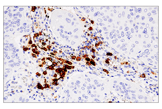 Immunohistochemistry Image 1: CD38 (E7Z8C) XP<sup>®</sup> Rabbit mAb (BSA and Azide Free)