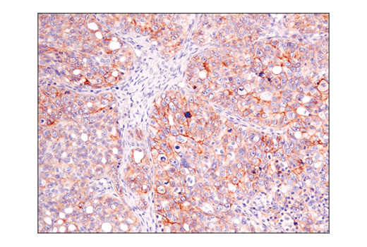 Immunohistochemistry Image 6: ASCT2 (D7C12) Rabbit mAb (BSA and Azide Free)