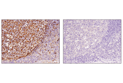 Immunohistochemistry Image 4: Clusterin (D7N2K) XP<sup>®</sup> Rabbit mAb