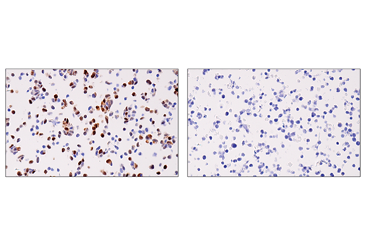 Immunohistochemistry Image 7: Cyclin D1 (E3P5S) XP<sup>®</sup> Rabbit mAb