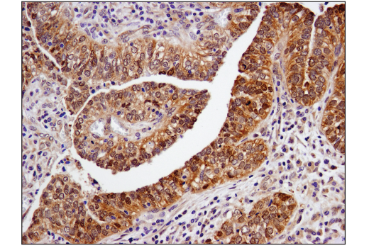 Immunohistochemistry Image 1: SMAD4 (D3R4N) XP<sup>®</sup> Rabbit mAb