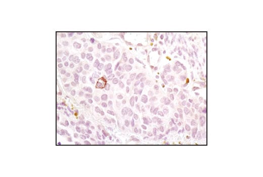 Immunohistochemistry Image 2: Notch1 (D1E11) XP<sup>®</sup> Rabbit mAb