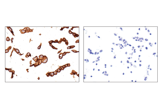 Immunohistochemistry Image 1: CD47 (D3O7P) Rabbit mAb