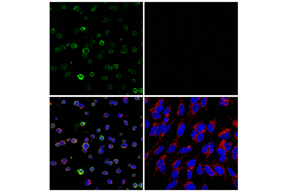 Immunofluorescence Image 1: TREM2 (E4F5G) Mouse mAb