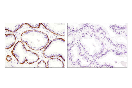 Immunohistochemistry Image 2: TRIM29/ATDC (E1L4E) Rabbit mAb