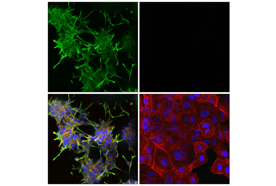 Immunofluorescence Image 1: Doublecortin (F6K9E) Rabbit mAb (BSA and Azide Free)