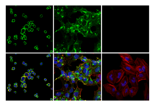 Immunofluorescence Image 1: TNFRSF8/CD30 (E7E4D) XP<sup>®</sup> Rabbit mAb