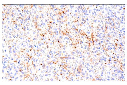 Immunohistochemistry Image 8: CD109 (E4I2V) Rabbit mAb
