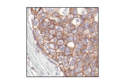 Immunohistochemistry Image 1: Pan-Cadherin Antibody