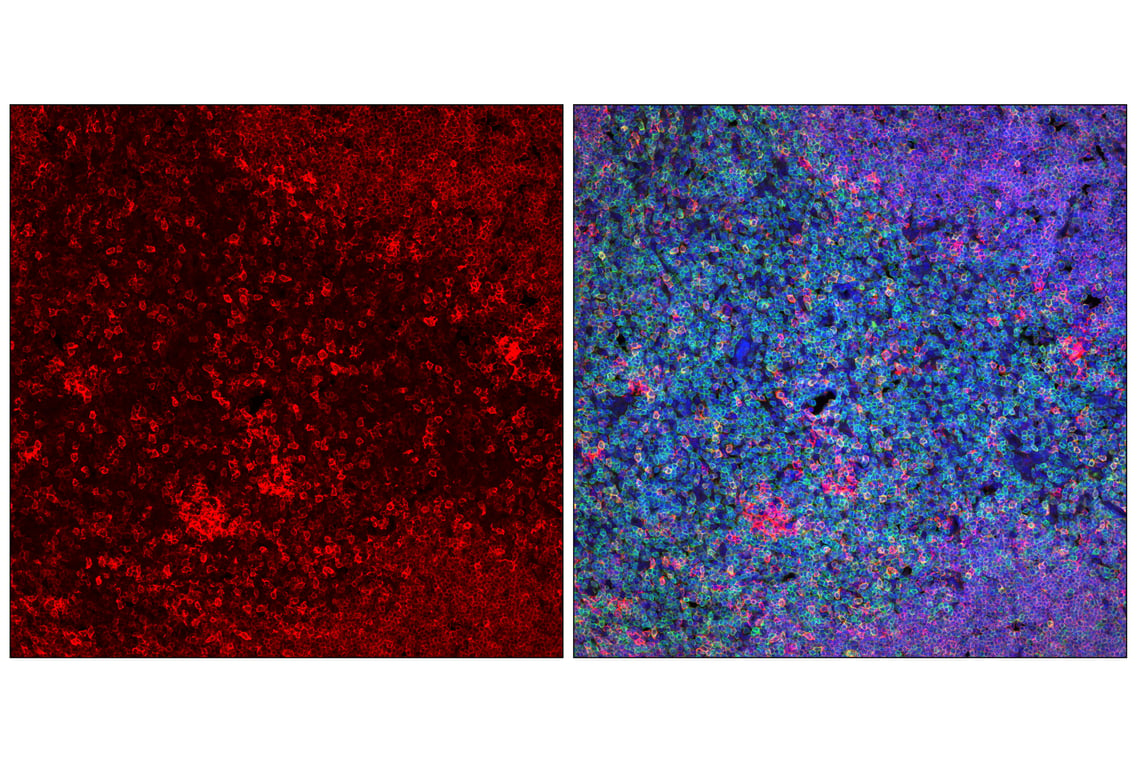 Immunofluorescence Image 1: SLAMF6/Ly108 (E2P7A) Rabbit mAb (Alexa Fluor<sup>®</sup> 647 Conjugate)