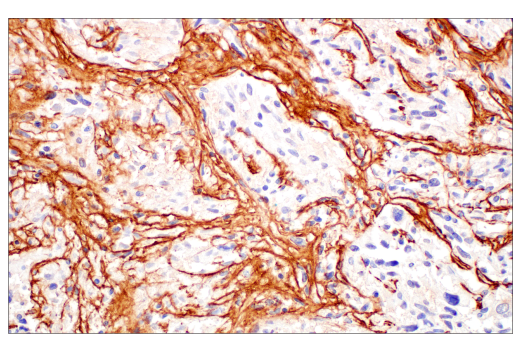 Immunohistochemistry Image 7: COL3A1 (E8D7R) XP<sup>®</sup> Rabbit mAb (BSA and Azide Free)