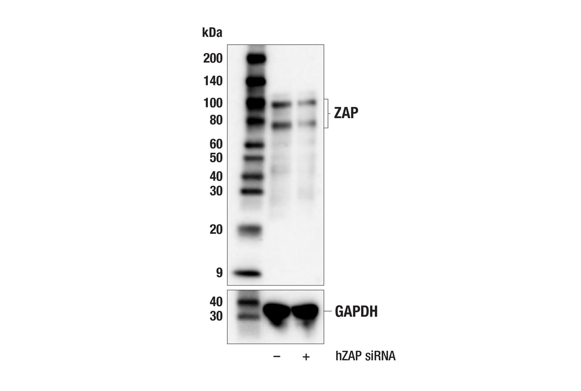 Western Blotting Image 3: ZAP (E5V4D) Rabbit mAb