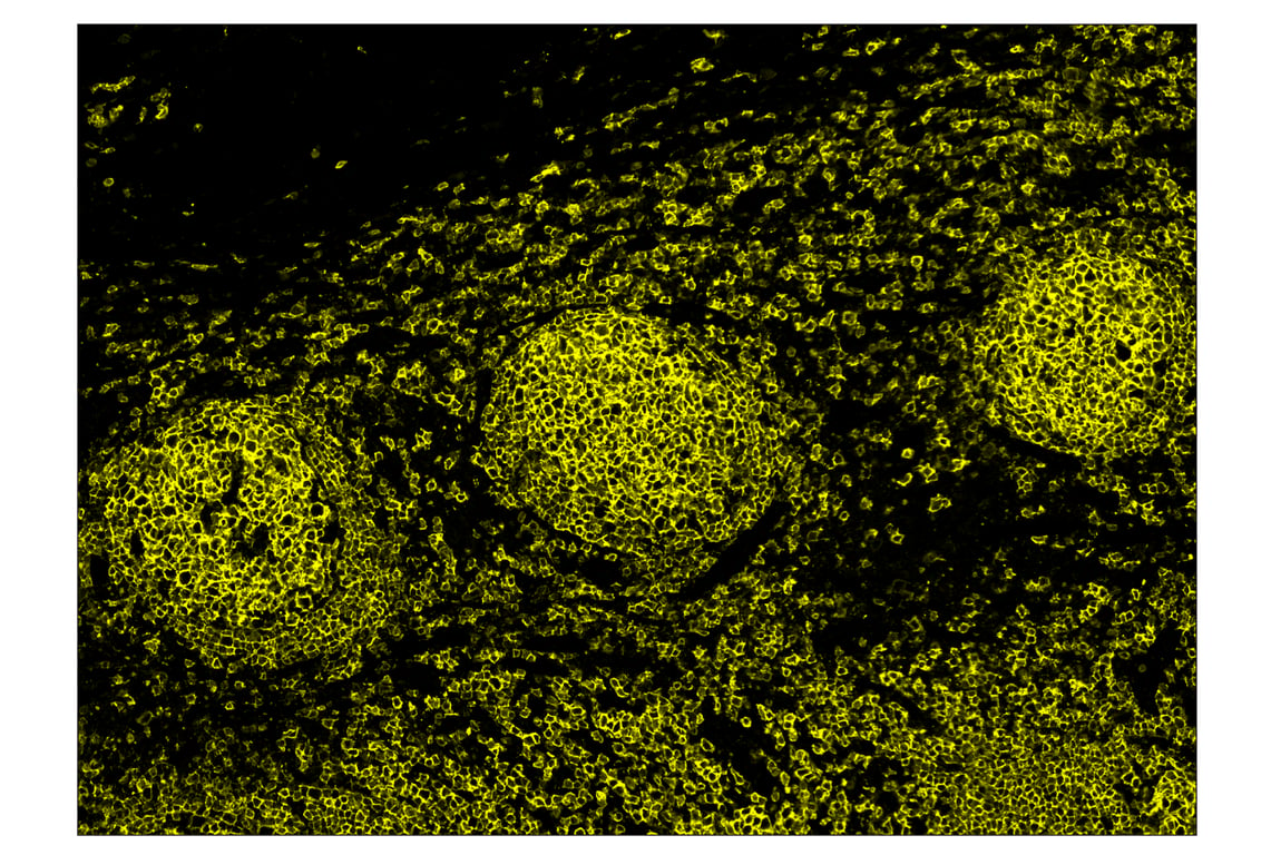 Immunohistochemistry Image 3: CD20 (E7B7T) & CO-0011-750 SignalStar<sup>™</sup> Oligo-Antibody Pair