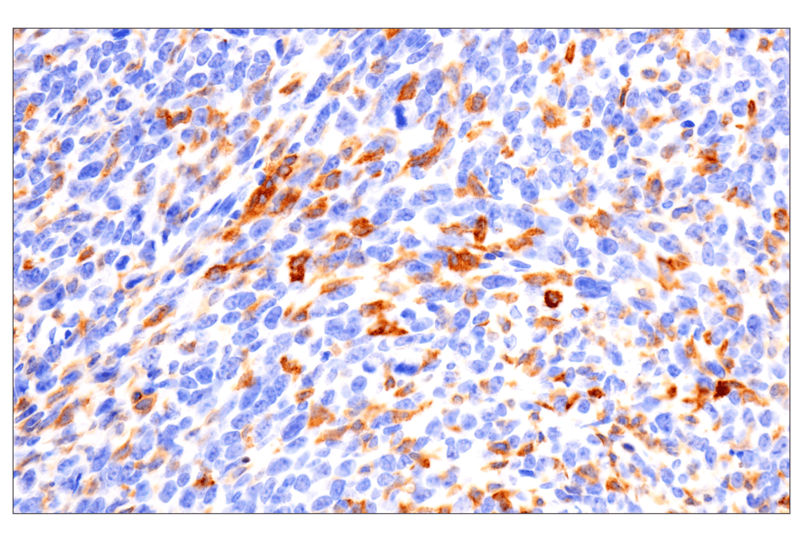 Immunohistochemistry Image 1: CD22 (F9D1W) Rabbit mAb (BSA and Azide Free)