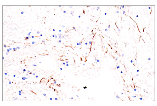 Immunohistochemistry Image 2: Neurofilament-H (E7Z7G) Rabbit mAb