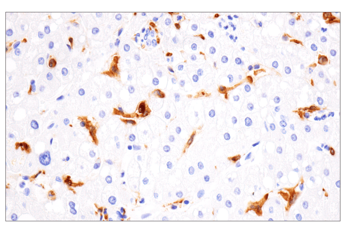 Immunohistochemistry Image 6: HLA-DRA (E9R2Q) XP<sup>®</sup> Rabbit mAb