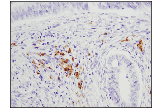 Immunohistochemistry Image 1: CD19 (Intracellular Domain) (D4V4B) XP<sup>®</sup> Rabbit mAb