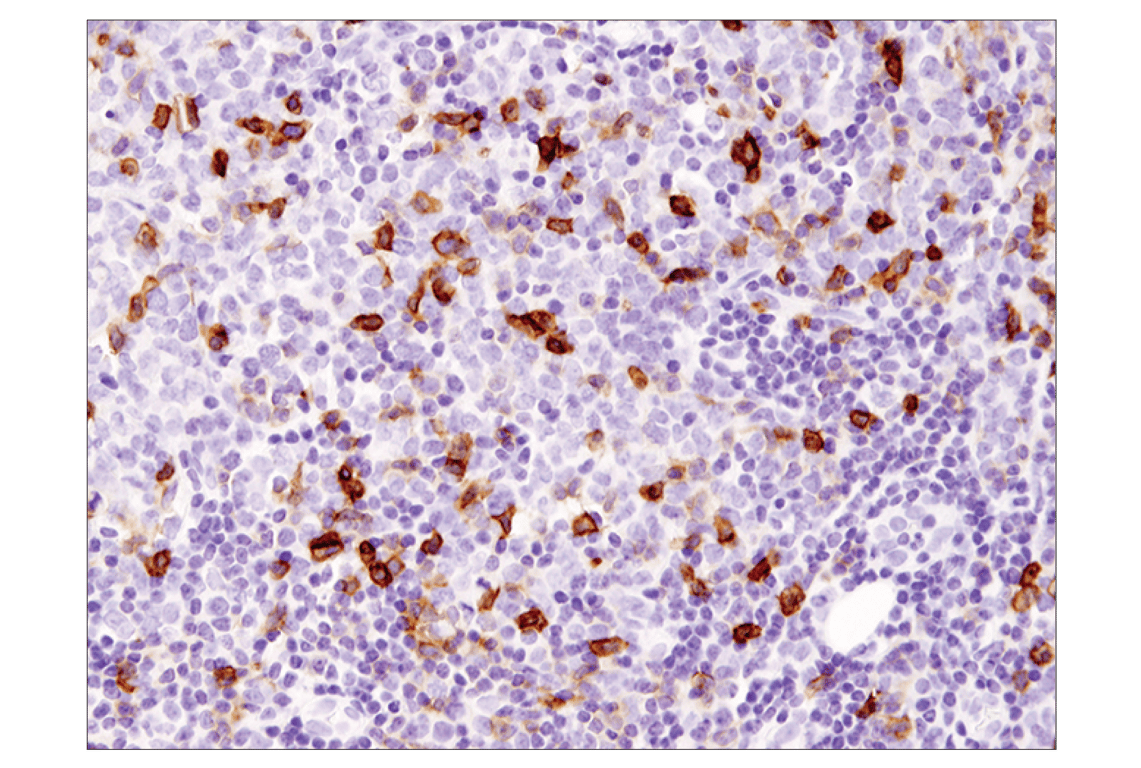 Immunohistochemistry Image 1: ICOS (D1K2T<sup>™</sup>) Rabbit mAb (BSA and Azide Free)