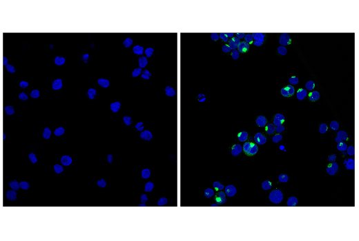 Immunofluorescence Image 1: IL-8 (E5F5Q) XP<sup>®</sup> Rabbit mAb