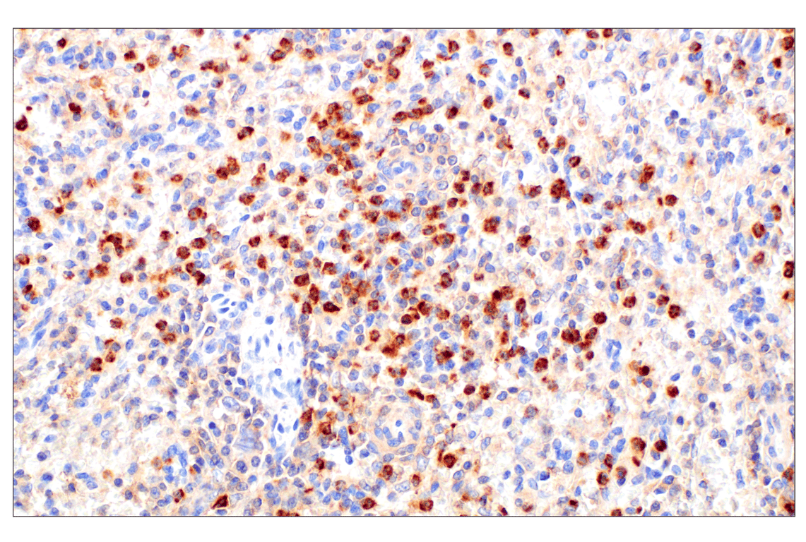undefined Image 16: Rho-GTPase Antibody Sampler Kit