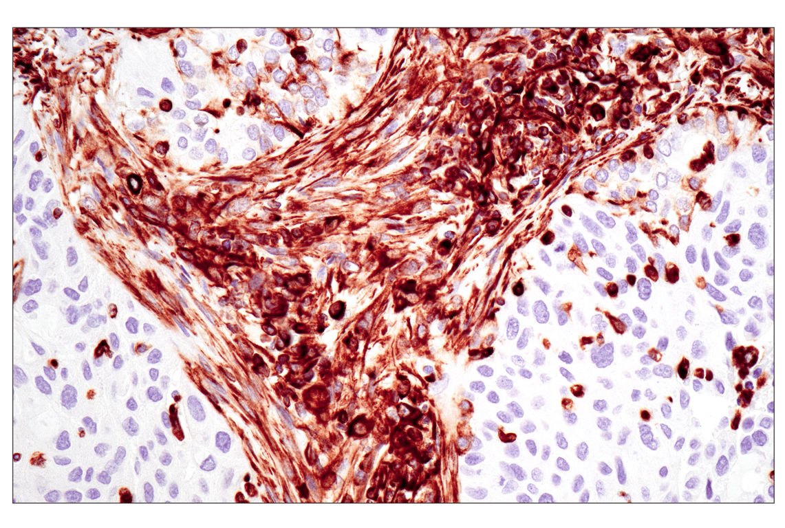 undefined Image 23: Cell Fractionation Antibody Sampler Kit