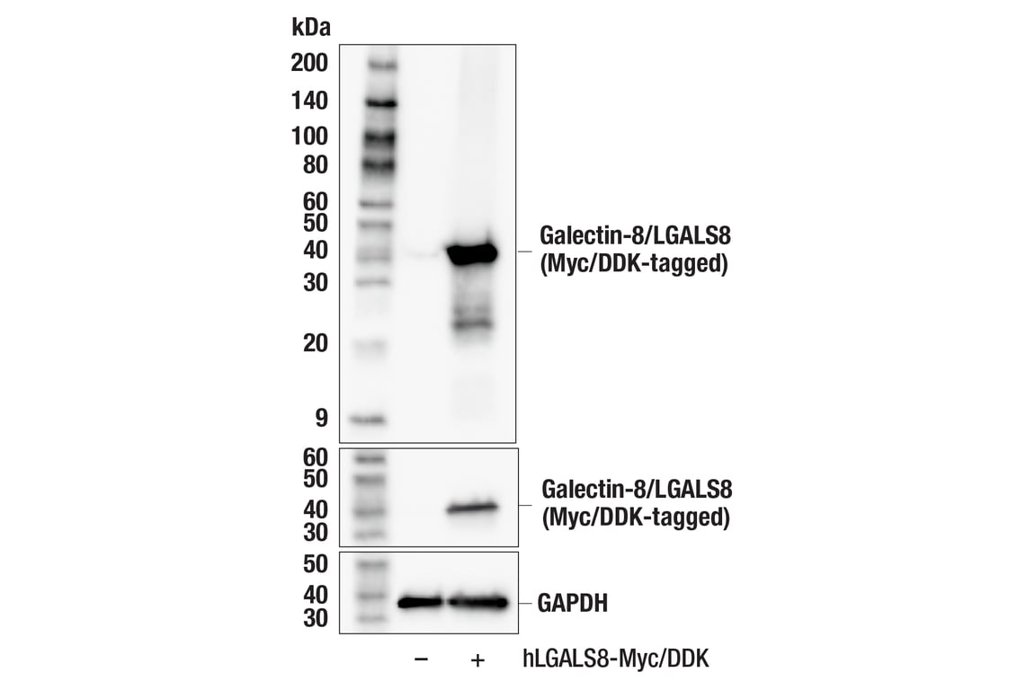 Western Blotting Image 2: Galectin-8/LGALS8 (F9O3T) Rabbit mAb