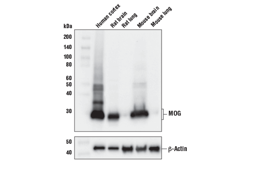 Western Blotting Image 1: MOG (E5K6T) XP<sup>®</sup> Rabbit mAb