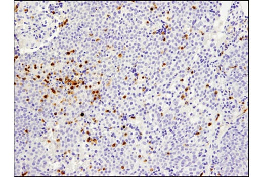 Immunohistochemistry Image 2: MMP-9 (D6O3H) XP<sup>®</sup> Rabbit mAb (BSA and Azide Free)