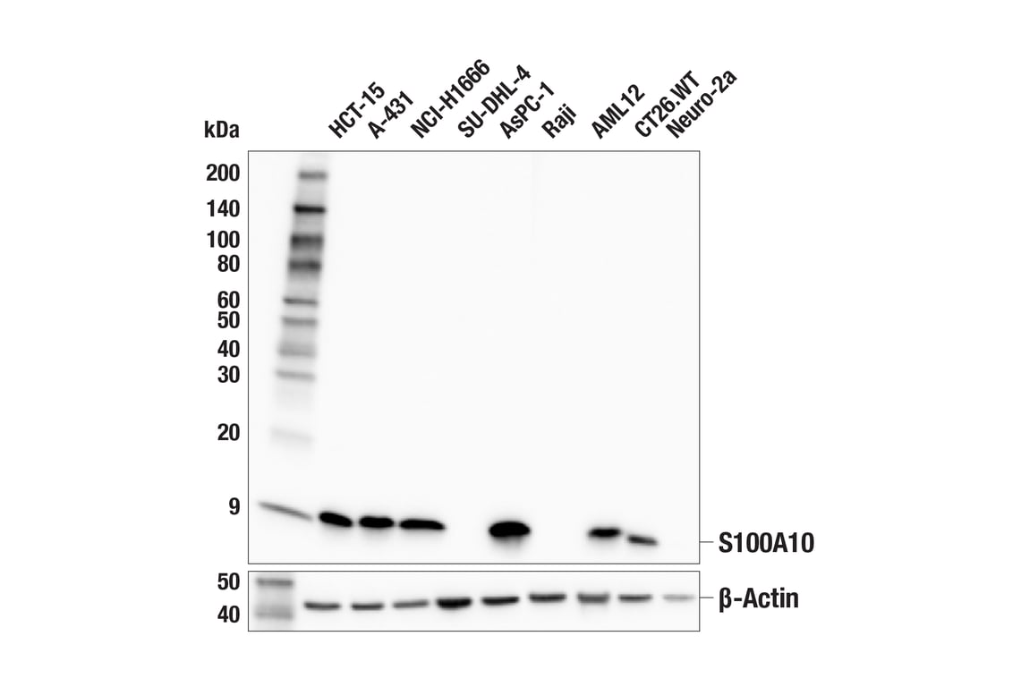 Western Blotting Image 1: S100A10 Antibody