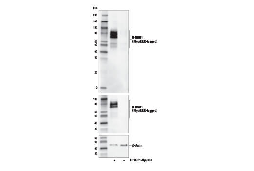 undefined Image 9: MHC Class I Antigen Processing and Presentation Antibody Sampler Kit